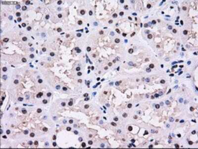 Immunohistochemistry-Paraffin: Gankyrin Antibody (OTI3F6) [NBP2-02199]