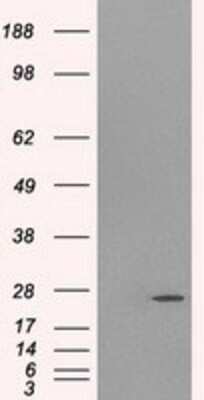 Western Blot: Gankyrin Antibody (OTI3F6) [NBP2-02199]