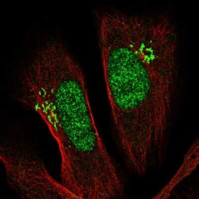 Immunocytochemistry/ Immunofluorescence: PSMD11 Antibody [NBP2-55793]