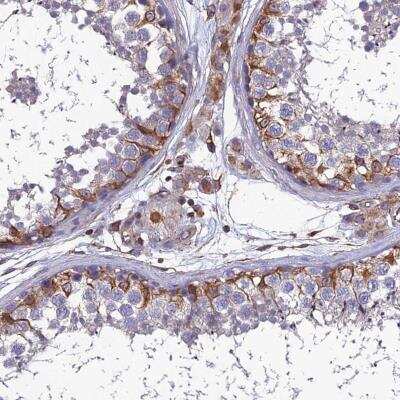 Immunohistochemistry: PSMD11 Antibody [NBP1-82700]