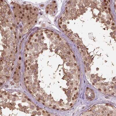 Immunohistochemistry-Paraffin: PSMD11 Antibody [NBP2-55793]