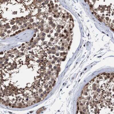 Immunohistochemistry-Paraffin: PSMD12 Antibody [NBP1-87801]