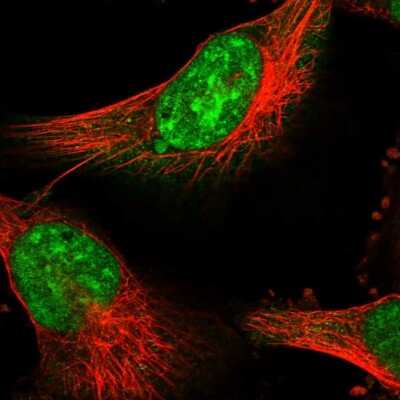 Immunocytochemistry/ Immunofluorescence: PSMD13 Antibody [NBP1-80961]