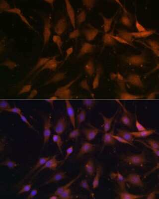 Immunocytochemistry/ Immunofluorescence: PSMD13 Antibody - BSA Free [NBP2-95231]