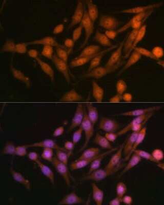 Immunocytochemistry/ Immunofluorescence: PSMD13 Antibody - BSA Free [NBP2-95231]