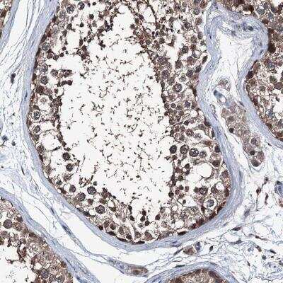 Immunohistochemistry-Paraffin: PSMD13 Antibody [NBP1-80961]