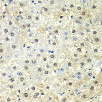 Immunohistochemistry-Paraffin: PSMD13 Antibody - BSA Free [NBP2-95231]