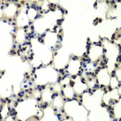 Immunohistochemistry-Paraffin: PSMD13 Antibody - BSA Free [NBP2-95231]