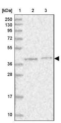 Western Blot: PSMD13 Antibody [NBP1-80961]