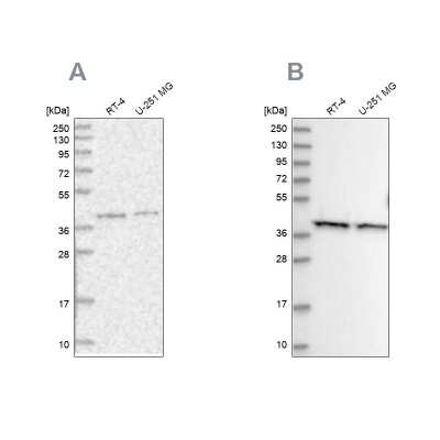 Western Blot: PSMD13 Antibody [NBP1-80961]