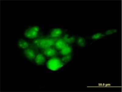 Immunocytochemistry/ Immunofluorescence: PSMD14 Antibody (4A10-E8) [H00010213-M01]