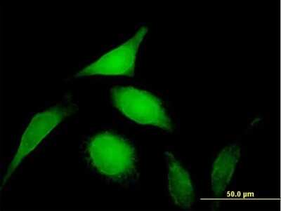 Immunocytochemistry/ Immunofluorescence: PSMD14 Antibody [H00010213-B02P]