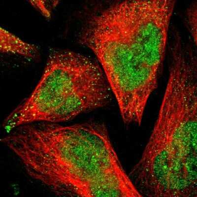 Immunocytochemistry/ Immunofluorescence: PSMD14 Antibody [NBP1-80956]
