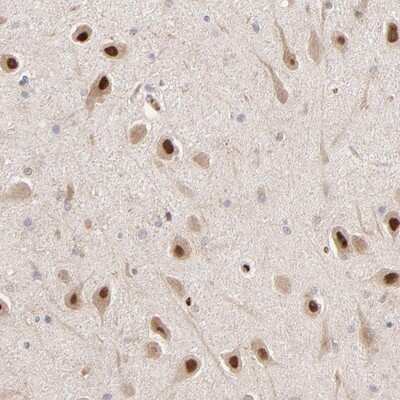 Immunohistochemistry-Paraffin: PSMD14 Antibody [NBP1-80956]