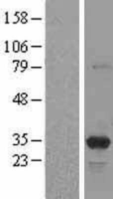 Western Blot: PA28 Activator gamma Subunit/PSME3 Overexpression Lysate [NBL1-14909]