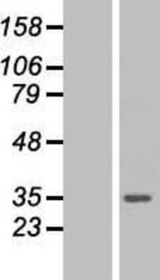 Western Blot: PA28 Activator gamma Subunit/PSME3 Overexpression Lysate [NBP2-05019]