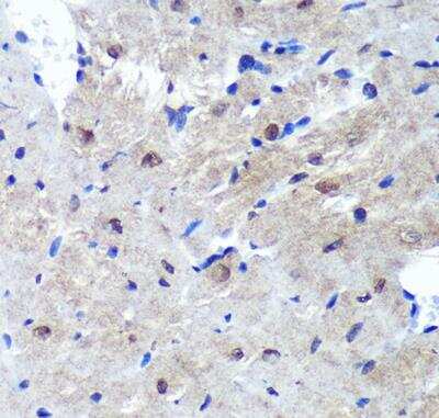 Immunohistochemistry-Paraffin: PSME4 Antibody - Azide and BSA Free [NBP2-94690]