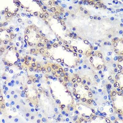 Immunohistochemistry-Paraffin: PSME4 Antibody - Azide and BSA Free [NBP2-94690]