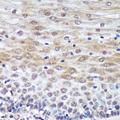 Immunohistochemistry-Paraffin: PSME4 Antibody - Azide and BSA Free [NBP2-94690]