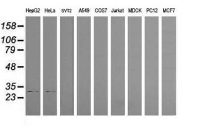Western Blot: PSMF1 Antibody (OTI2D7)Azide and BSA Free [NBP2-73707]