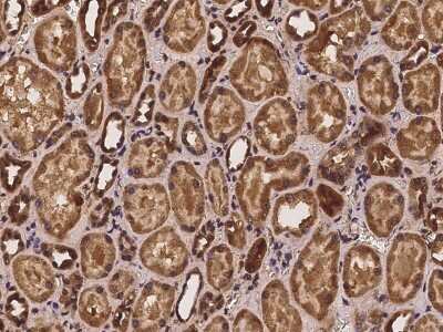 Immunohistochemistry-Paraffin: PSMG3 Antibody [NBP2-97973]