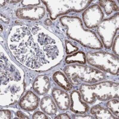 Immunohistochemistry-Paraffin: PSMG4 Antibody [NBP3-17615]