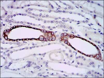 Immunohistochemistry: PSP/BPIFA2 Antibody (1F12) - BSA Free [NBP2-37493]