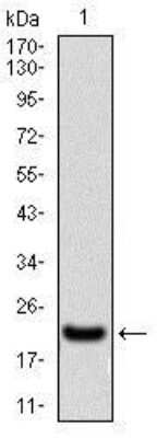 Western Blot: PSP/BPIFA2 Antibody (2B4F5)BSA Free [NBP2-37273]