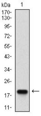 Western Blot: PSP/BPIFA2 Antibody (3F8E4)BSA Free [NBP2-37277]