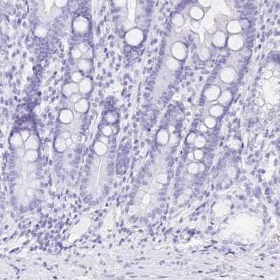 Immunohistochemistry-Paraffin: PSP/BPIFA2 Antibody [NBP1-91704]