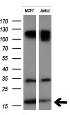 Western Blot: PSP94/MSMB Antibody (OTI3D5) [NBP2-45798]