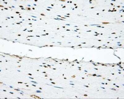 Immunohistochemistry: PSP94/MSMB Antibody (OTI6C7) - Azide and BSA Free [NBP2-73624]
