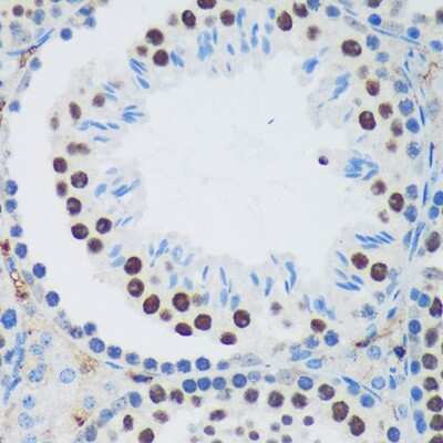 Immunohistochemistry-Paraffin: PSPC1 Antibody - Azide and BSA Free [NBP2-93111]