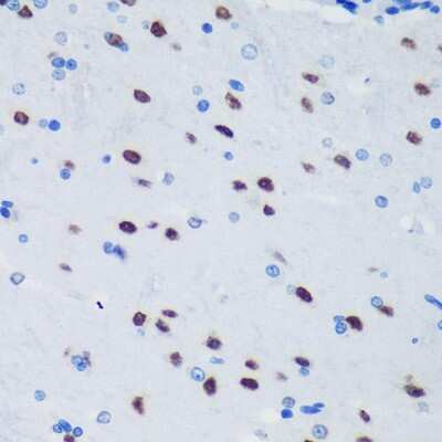 Immunohistochemistry-Paraffin: PSPC1 Antibody - Azide and BSA Free [NBP2-93111]