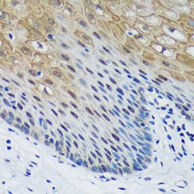 Immunohistochemistry-Paraffin: PSPC1 Antibody - Azide and BSA Free [NBP2-93111]