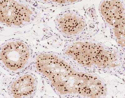 Immunohistochemistry-Paraffin: PSPC1 Antibody [NBP3-12643]