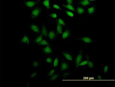Immunocytochemistry/ Immunofluorescence: PSRC2 Antibody [H00196441-B01P]