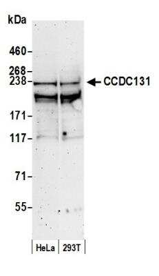Western Blot: PSRC2 Antibody [NB100-68267]