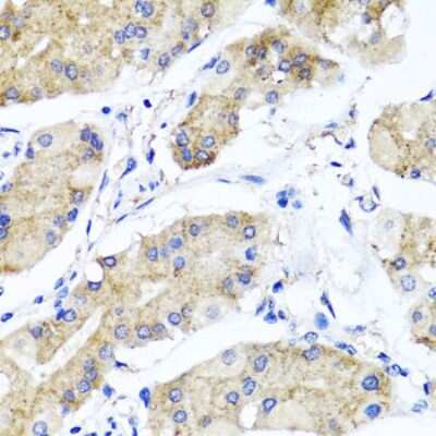 Immunohistochemistry-Paraffin: PSTPIP1 Antibody - BSA Free [NBP2-93547]