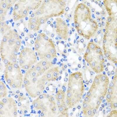 Immunohistochemistry-Paraffin: PSTPIP1 Antibody - BSA Free [NBP2-93547]