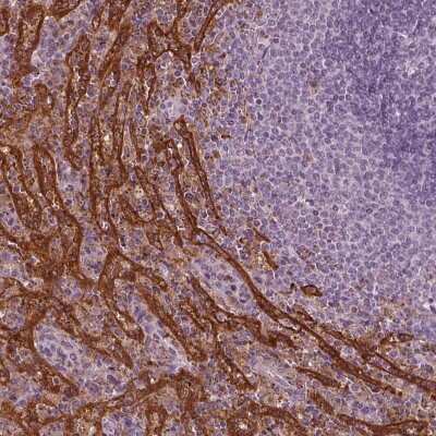 Immunohistochemistry-Paraffin: PSTPIP2 Antibody [NBP1-85846]