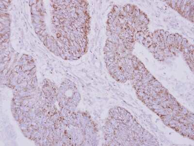 Immunohistochemistry-Paraffin: PSTPIP2 Antibody [NBP2-19995]