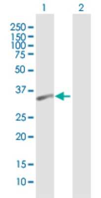 Western Blot: PSTPIP2 Antibody [H00009050-B01P]