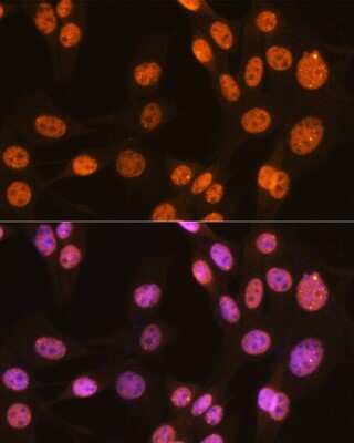 Immunocytochemistry/ Immunofluorescence: PTBP1 Antibody (9M6A8) [NBP3-16197]