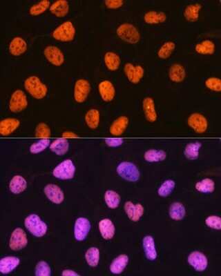 Immunocytochemistry/ Immunofluorescence: PTBP1 Antibody (9M6A8) [NBP3-16197]