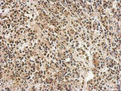 Immunohistochemistry-Paraffin: PTBP1 Antibody [NBP2-19996]