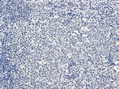 Immunohistochemistry-Paraffin: PTBP1 Antibody (S01-1G2) [NBP3-19910]