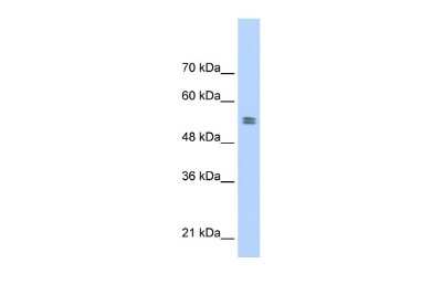 Western Blot: PTBP1 Antibody [NBP1-57123]
