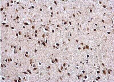Immunohistochemistry-Paraffin: PTBP2 Antibody [NBP2-19997]