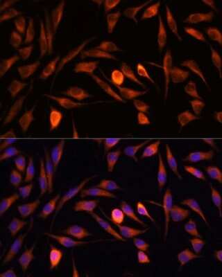 Immunocytochemistry/ Immunofluorescence: PTCD1 Antibody - Azide and BSA Free [NBP2-93462]
